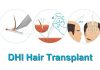 DHI Hair Transplant