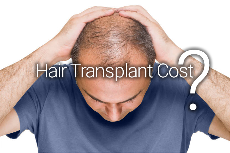 hair implants cost