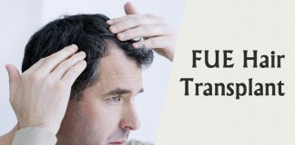 FUE hair transplant