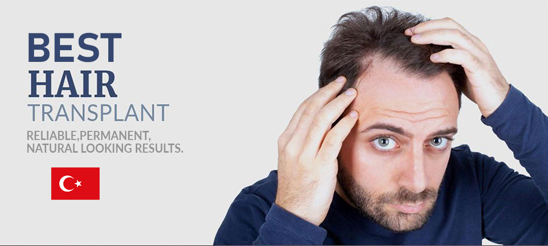 How To Choose Best Hair Transplant Clinic In Turkey Hair Treatment In