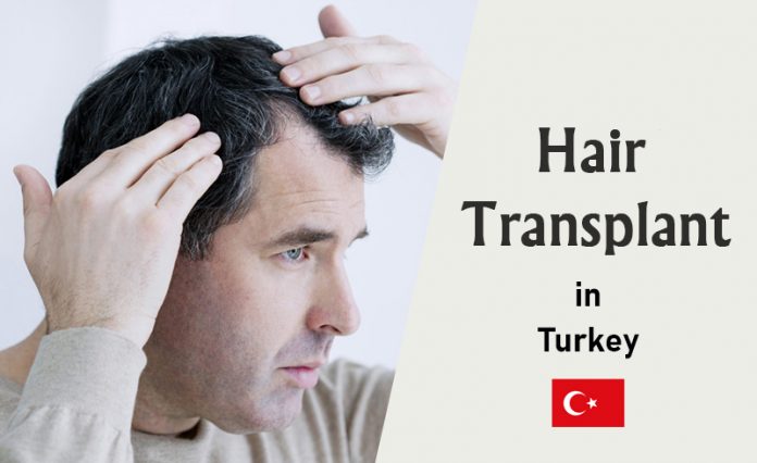 hair transplant prices in Turkey