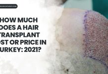 how much does a hair transplant cost or price in turkey
